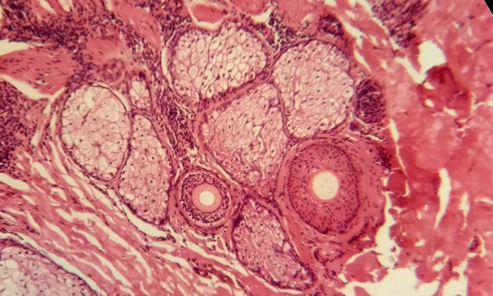 Microbiology and histopathology samples